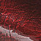 Red Patent