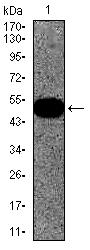 An arrow moves to highlight the location of a solid horizontal line on a Western blot. The line moves up and down, while the background remains consistent.