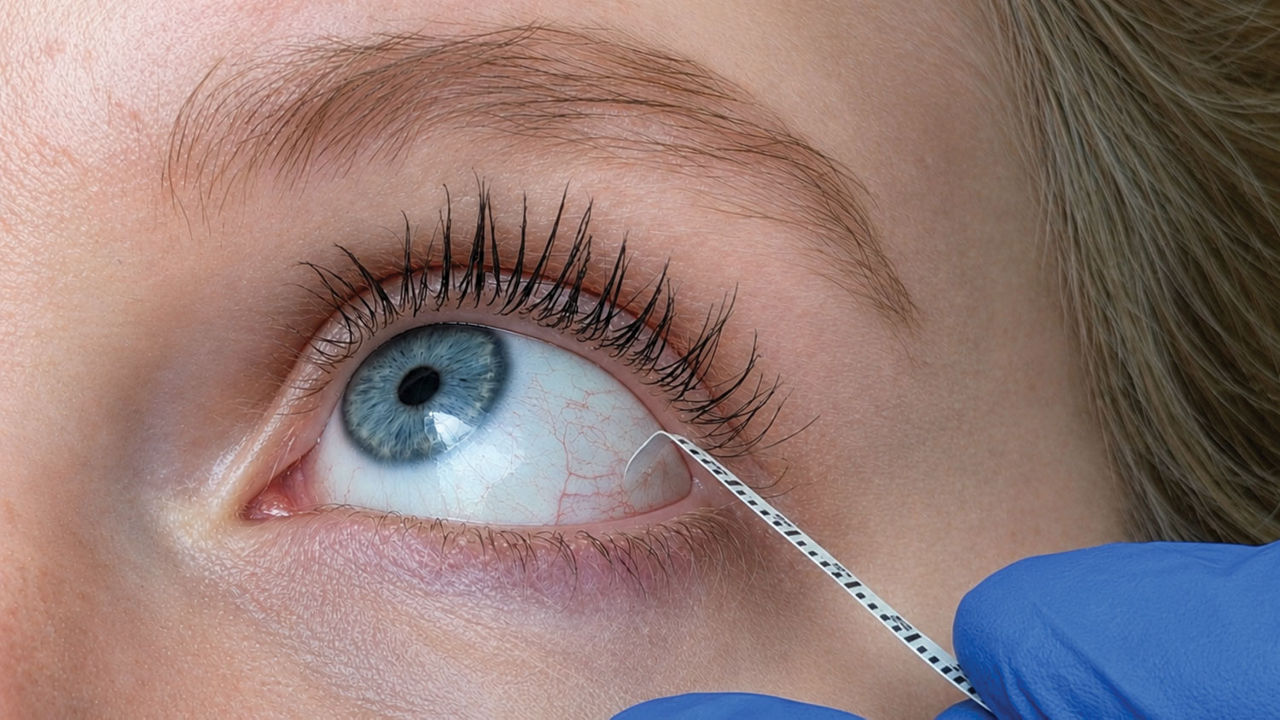 Our tears can help diagnose cancer, Parkinson's, and Alzheimer's