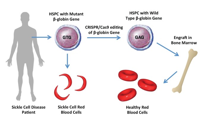 Crispr Edits Sickle Cell Mutation 6170