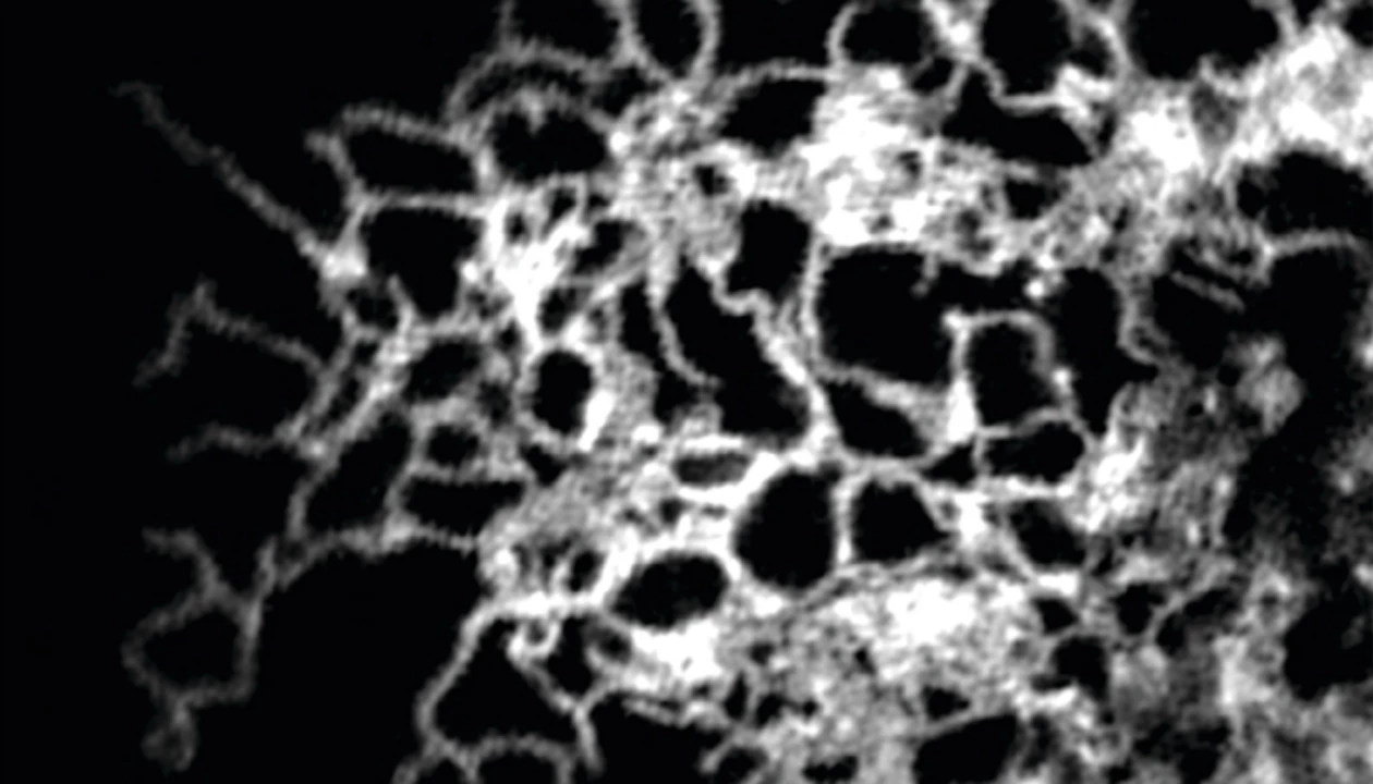 Superresolution methods reveal new picture of the endoplasmic reticulum
