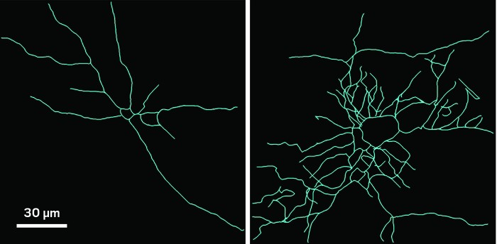 evolution-repurposed-bone-gene-brain