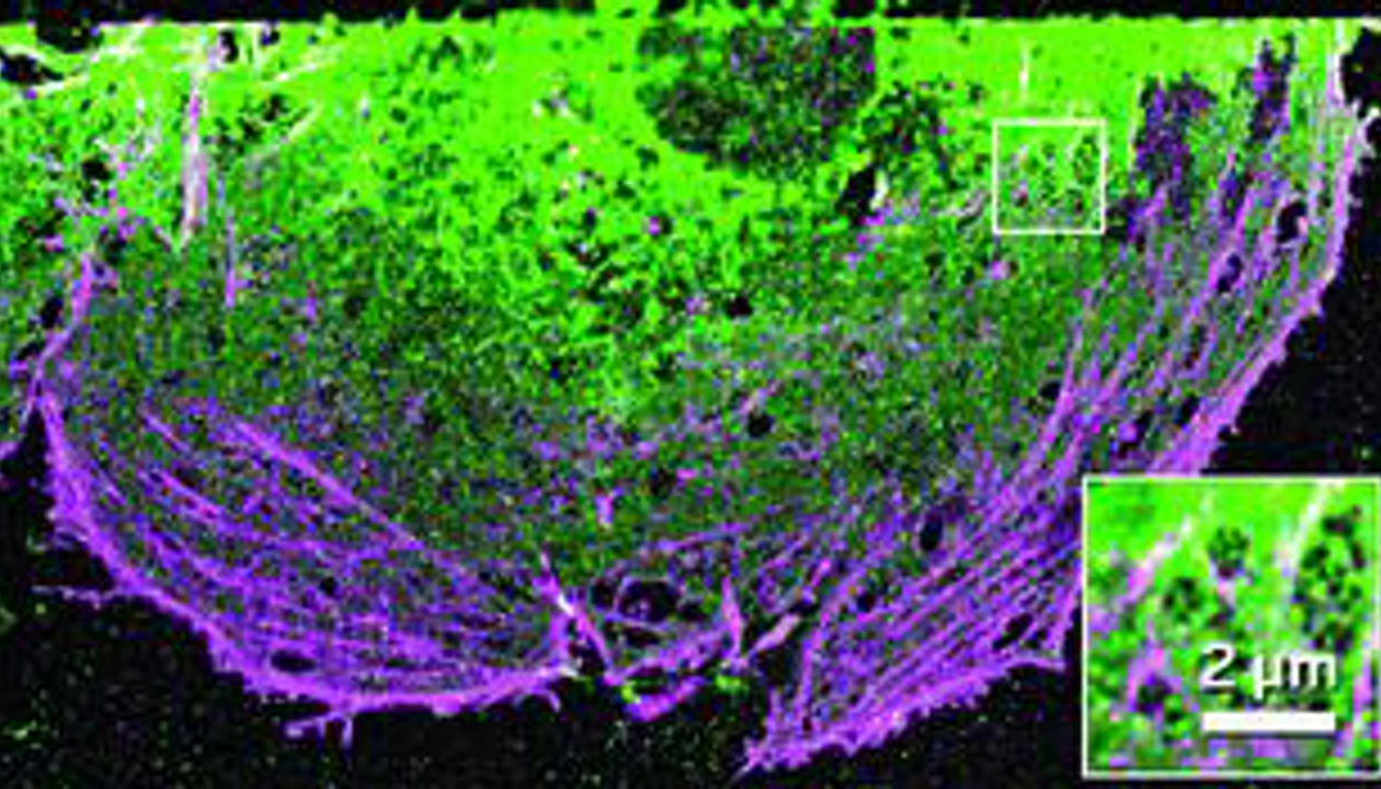 Getting a bigger picture with superresolution microscopy