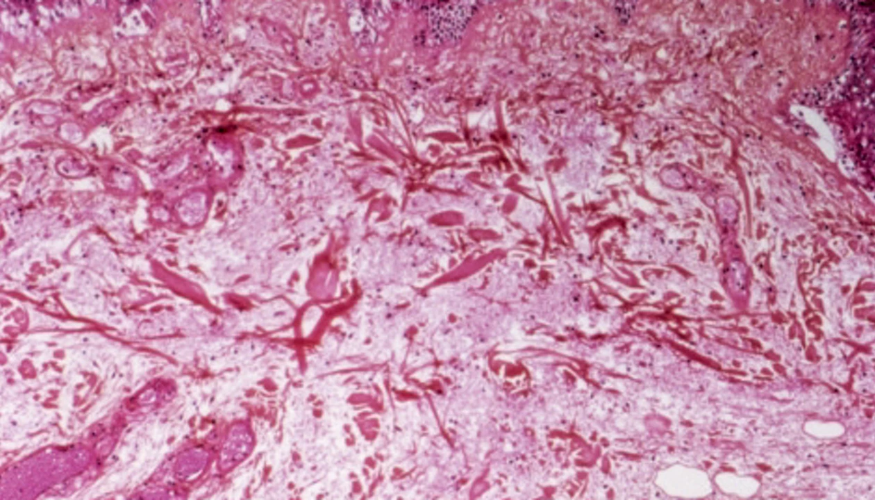 Technique eases analysis of damaged RNA