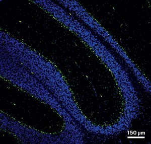 A stained mouse brain showing oligonucleotides in the cerebellum.