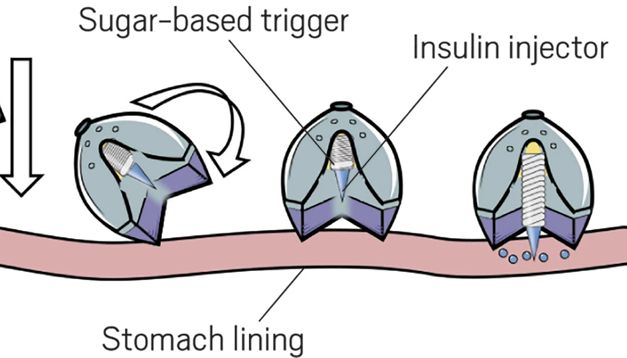 Tortoise-inspired, ingestible device flips itself upright to inject ...