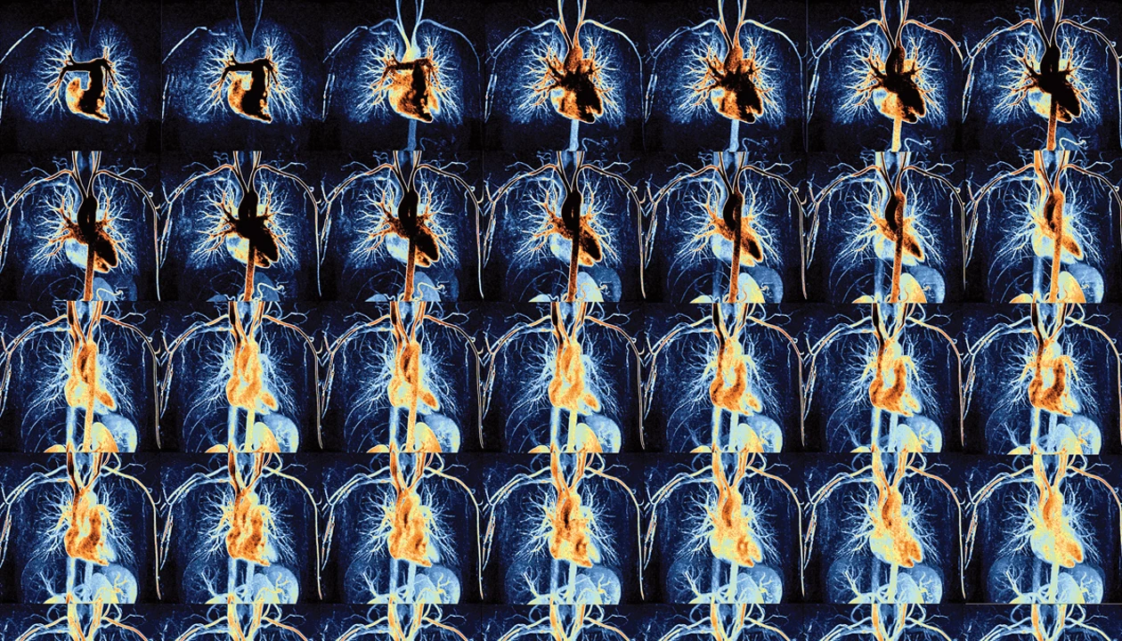 50 years of MRI