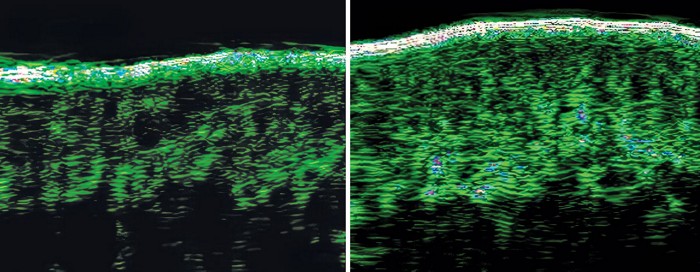 Collagen levels before and after 56 days of probiotic use.