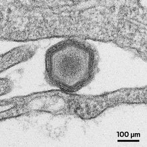 A grayscale electron micrograph of an African swine fever virus particle.