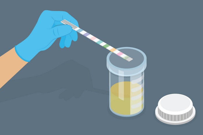 A flat illustration shows a gloved hand holding a multicolored test strip above a sample vial of urine.