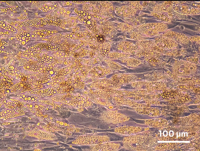 A light micrograph of cultured cells that are clear and roughly boat shaped but filled with round droplets that scatter the light differently. These are lipid droplets.