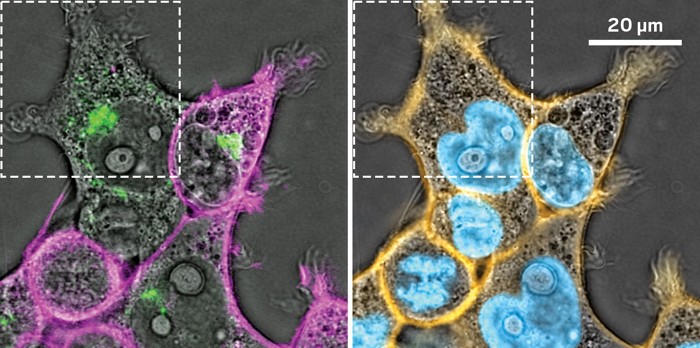 Two side-by-side images of cells. The left has a gray backgroun and is splotched with green and pink highlights. The right has the same grey background but has blue blobs inside the grey cells and orange outlines.