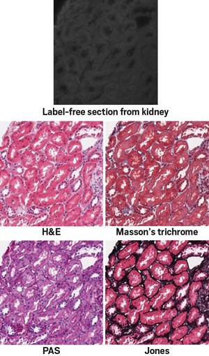 A dark, hard-to-interpret image of cells sits above four pink and purple images that look similar but feature slightly different shades.