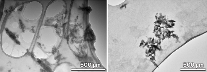 Two black and white images side by side. The one on the left is a close up of nanoplastic fragments found in the human brain. On the left is a cluser of nanoplastic found in the human kidney.