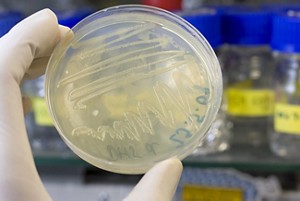 Photograph of a researcher holding an agar plate containing bacteria.