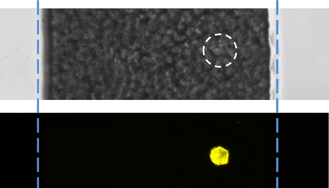 Counting Cancer Cells Quickly