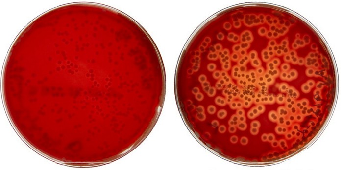 Attacking Cancer Light Controlled Bacteria