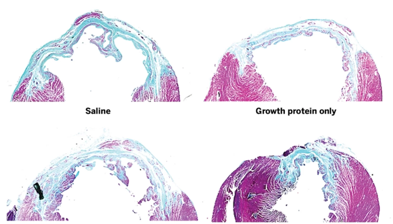 Repairing The Heart With A Protein-Hydrogel Combo