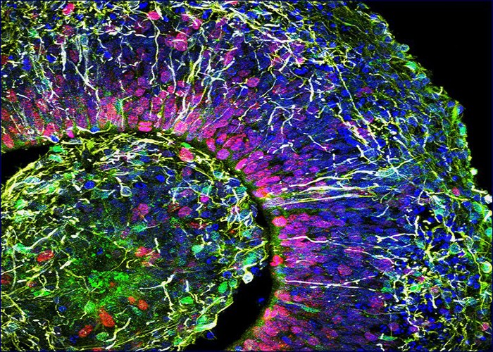 Chemistry in Pictures: Brain in a dish