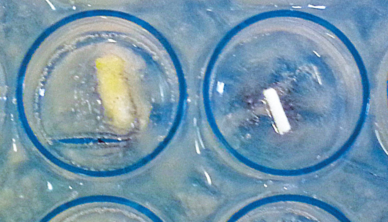 Biodegradable breast biopsy markers
