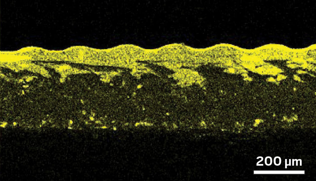 Crafting polymer composites in one step with light