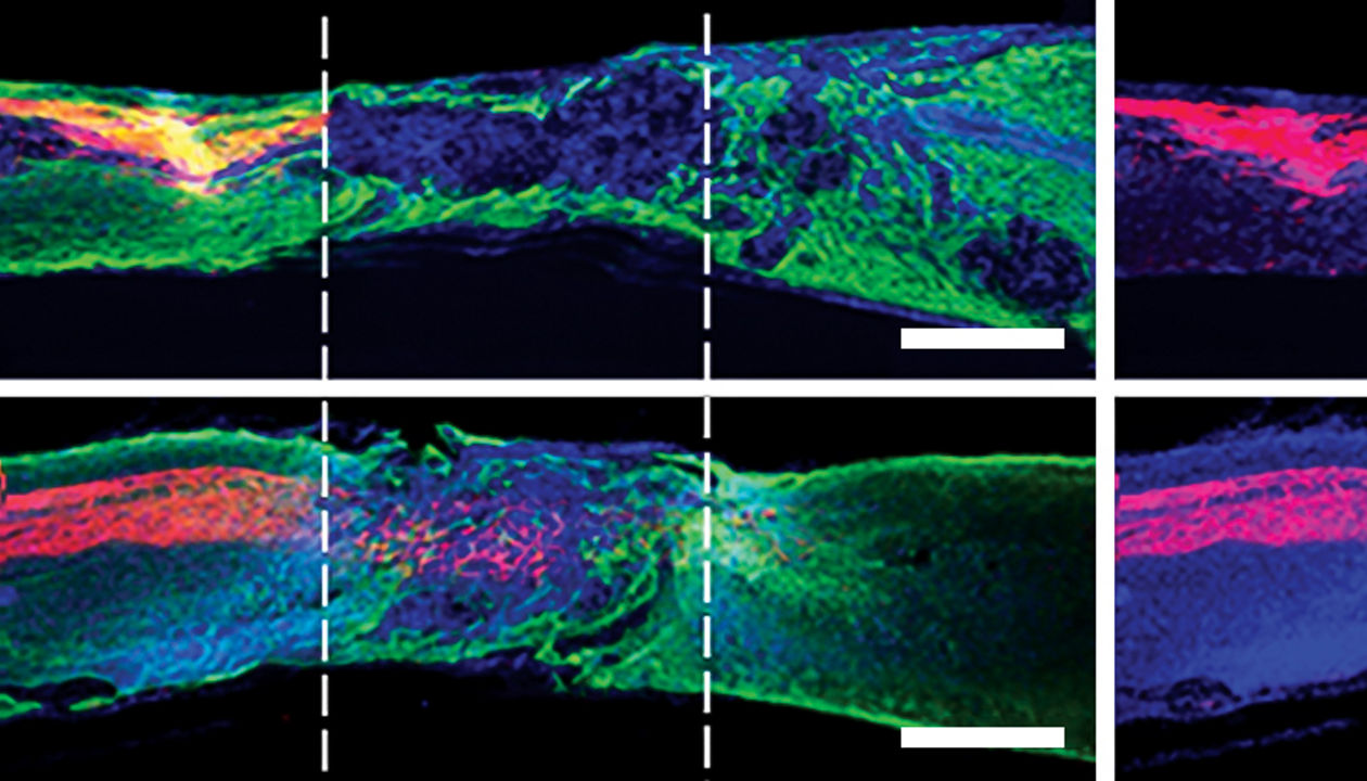 Supramolecular polymers treat spinal cord injury in mice