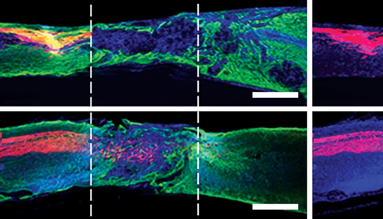 Supramolecular polymers treat spinal cord injury in mice
