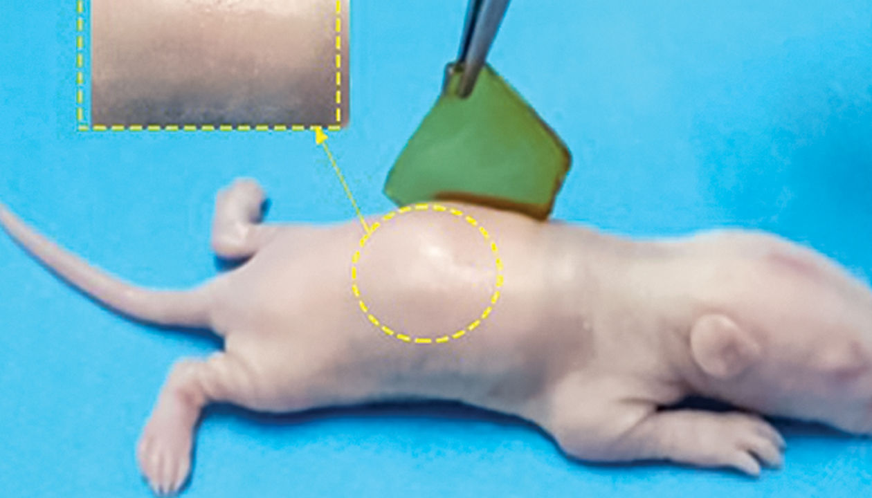 Strong hydrogel adhesive comes painlessly off sensitive skin