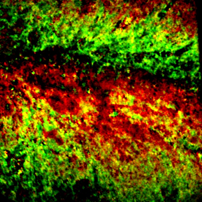 Microscopy method maps chemistry, not just chemicals