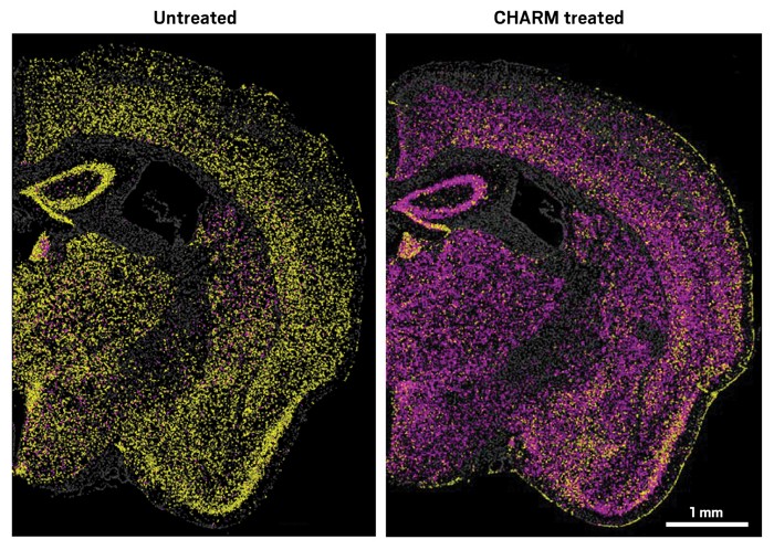 Un editor epigenético silencia las proteínas priónicas en el cerebro de un ratón