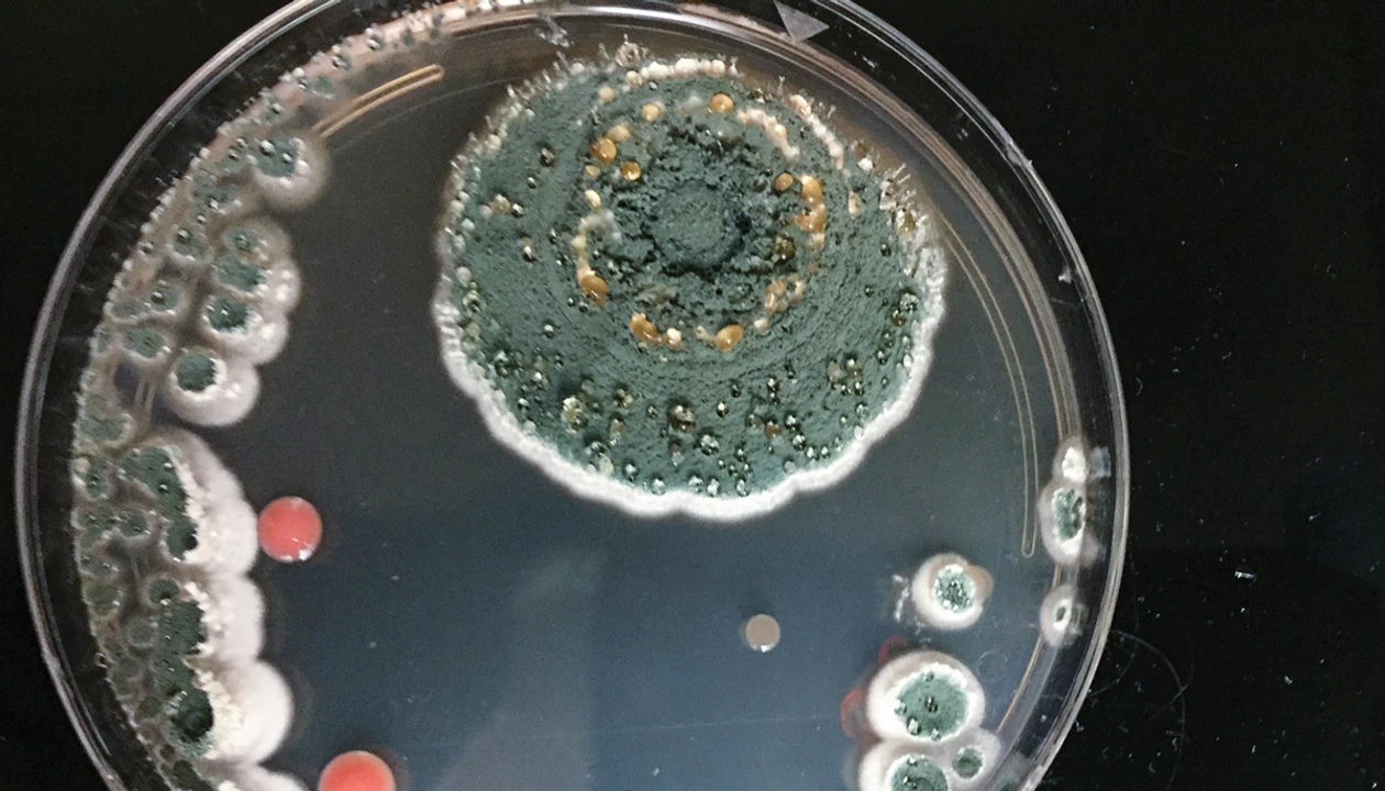 Scientists ponder the peat bog to fight TB