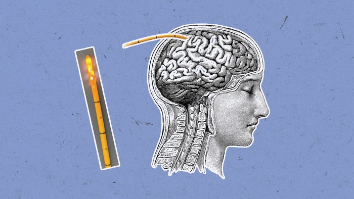 At left, an orange catheter with a glowing tip and periodic black lines running down its length sits on a lab bench. At right, a three-dimensional rendering of a skull shows how the catheter would be inserted through the skull and into brain tissue.