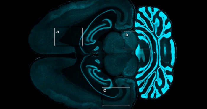 By toggling antibody binding, researchers see into dense tissues