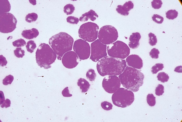 How the bone marrow microenvironment responds to immunotherapy