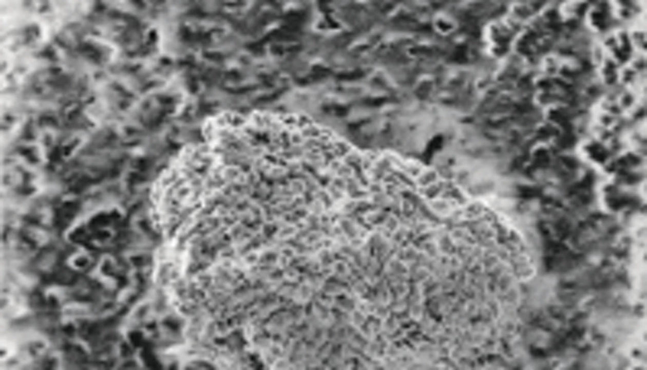 FBI's Anthrax Analysis