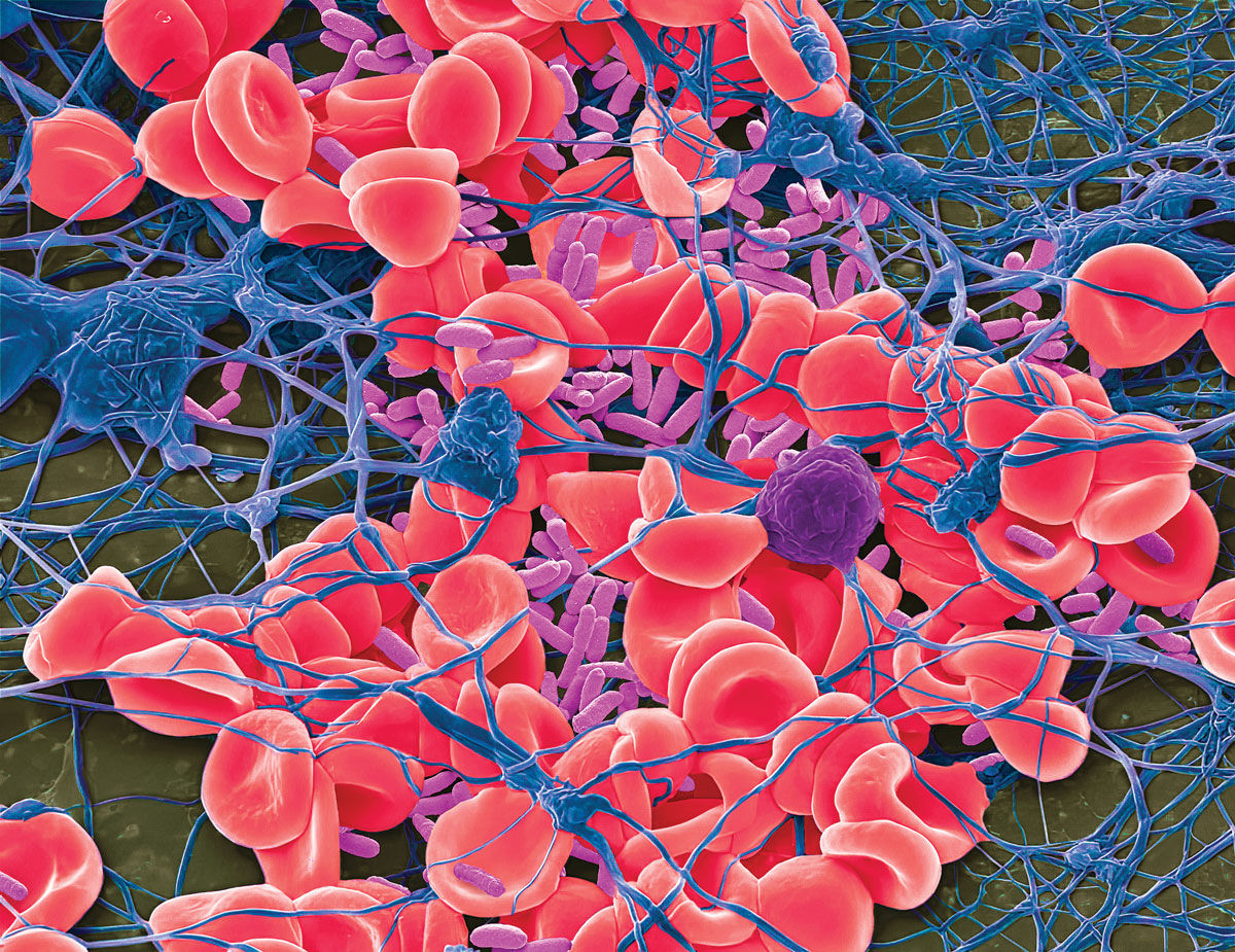 All-in-one test could fast-track care for people with possible sepsis