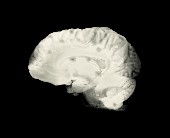 How a carbohydrate-rich mesh protects our brain