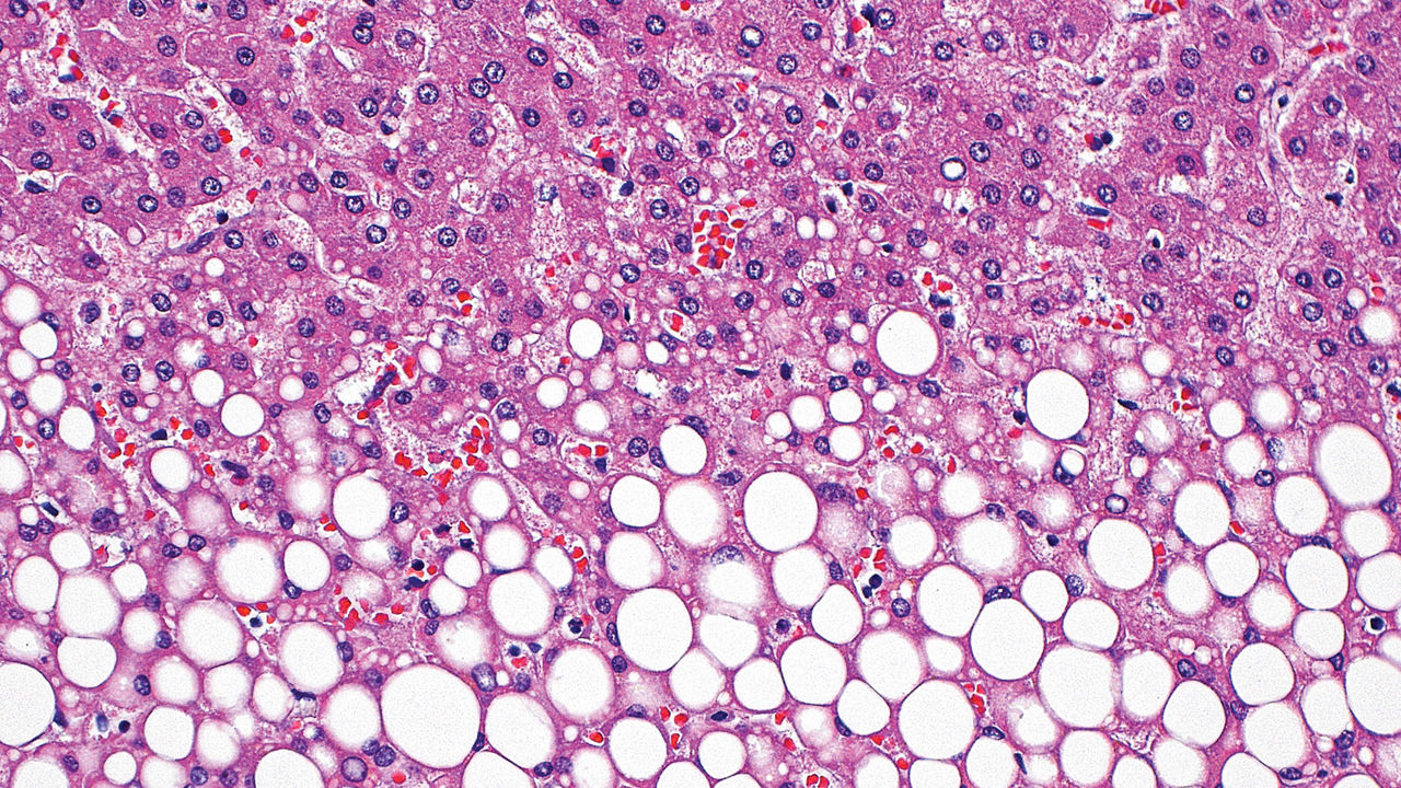Not just GLP-1: Peptide-drug conjugate hits 5 obesity targets