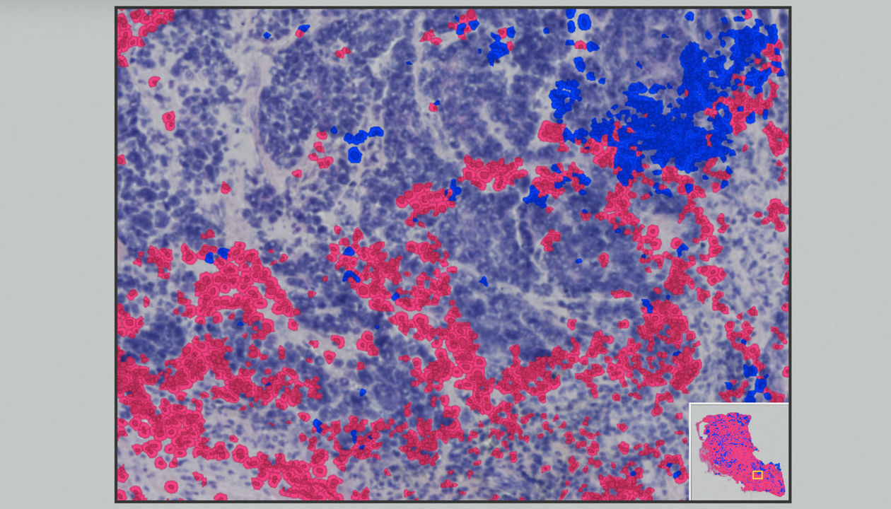 Spatial biology maps the chemistry of cells