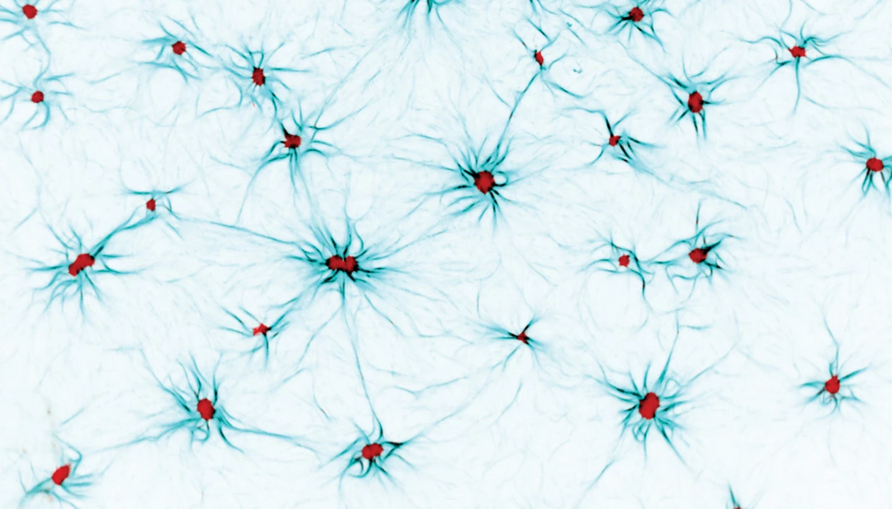 ‘Major advance’ shows how earthquake-like events may help cells move