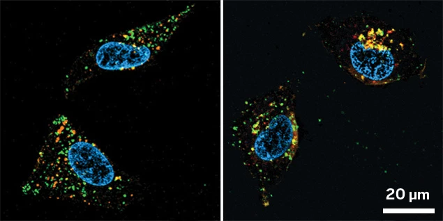 Confocal microcopy images of cells.