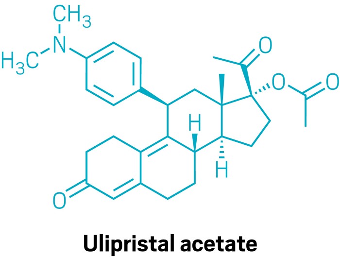 Ulipristal acetate can be used in a medication abortion regimen