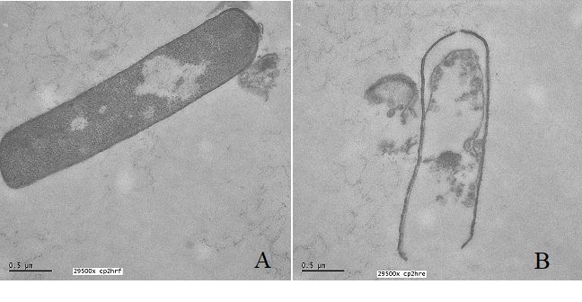 Clostridiumperfringens