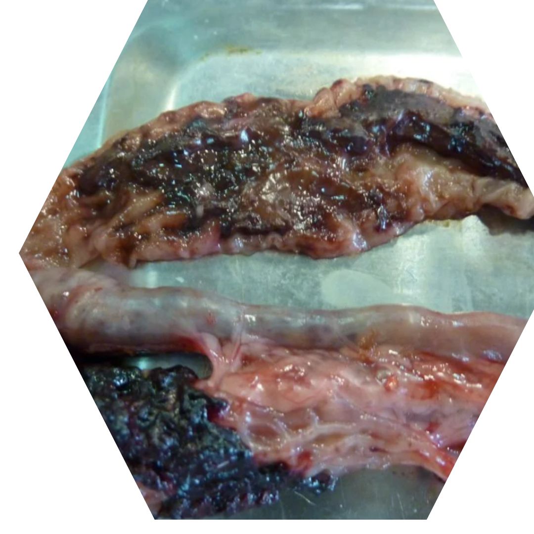 Copy of Hexagon Image Frame - 3