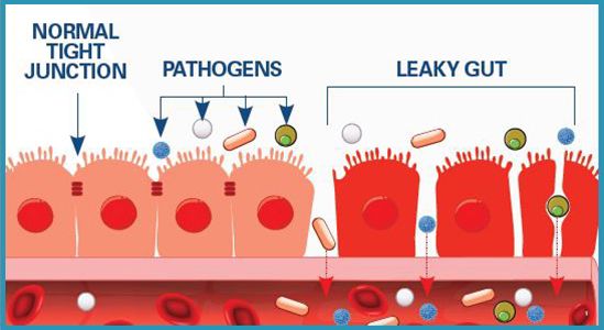 Leaky Gut Barrier Illustration