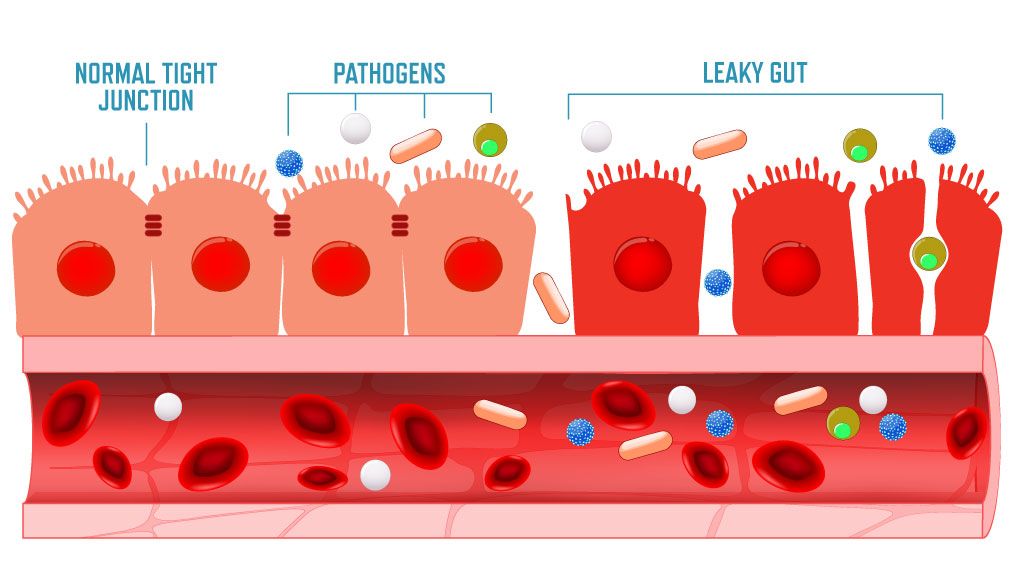 Leaky Gut Illustration