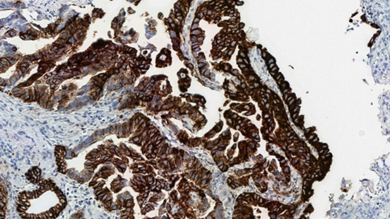 Cytoplasmic blushing due to suboptimal fixation