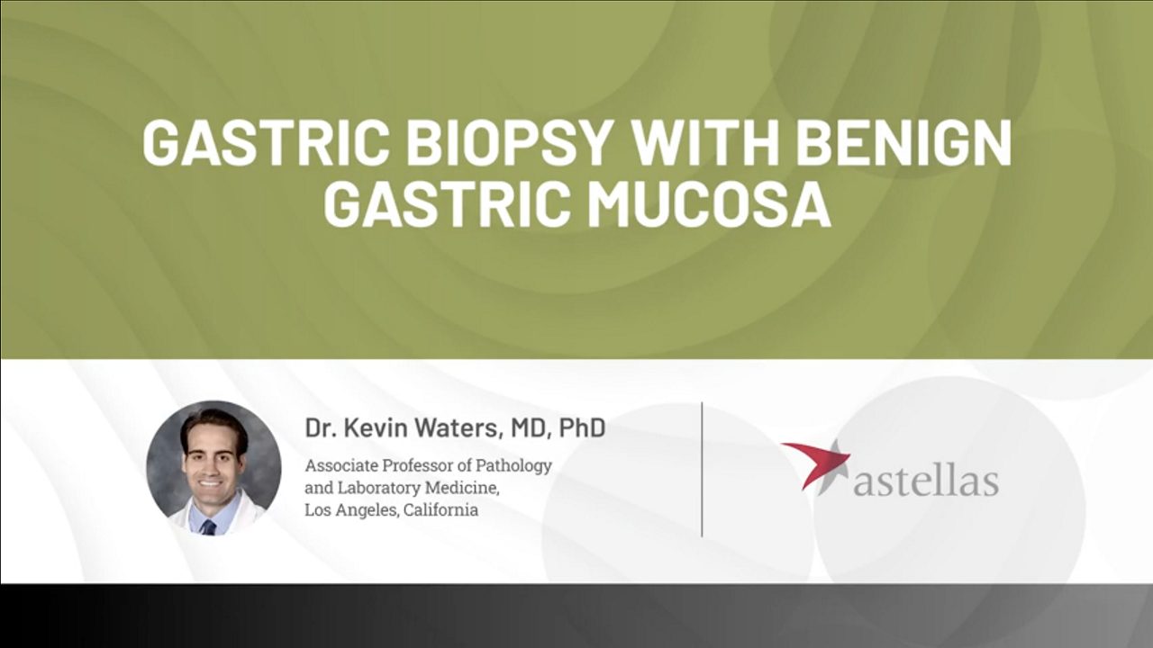    Gastric biopsy with benign gastric mucosa expert case review