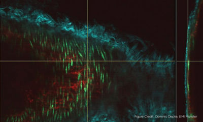 Laser Microscopes are Key Tools in Biology