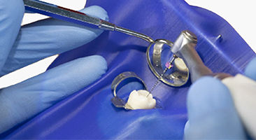 Gloved hands performing endodontic treatment under dental dam isolation, illustrating practical training in procedure-based courses.